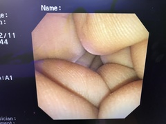 Video Transnasal Gastroscope｜GIF-N260｜Olympus Medical Systems photo7