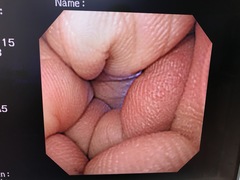 Video Gastroscope｜GIF-XQ230｜Olympus Medical Systems photo7