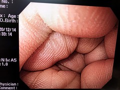 Video Gastroscope｜GIF-H260｜Olympus Medical Systems photo7