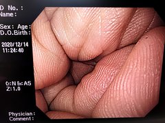 Video Gastroscope｜GIF-H260｜Olympus Medical Systems photo7