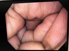 Video Gastroscope｜GIF-H170｜Olympus Medical Systems photo7