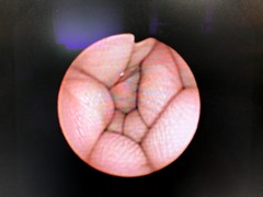 Fiber Bronchoscope｜BF-1T60｜Olympus Medical Systems photo7