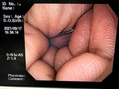 Video Gastroscope｜GIF-Q240X｜Olympus Medical Systems photo7
