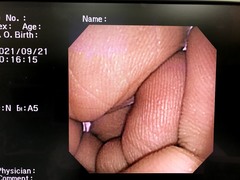Video Transnasal Gastroscope｜GIF-XP260N｜Olympus Medical Systems photo7