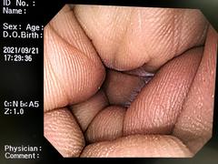Video Gastroscope｜GIF-Q260｜Olympus Medical Systems photo7