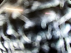 Video Colonoscope｜CF-Q260AI｜Olympus Medical Systems photo7