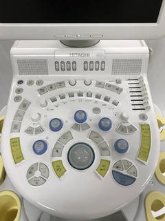 Ultrasound system(Color)｜HI VISION Avius｜Hitachi photo7