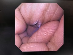 Video Gastroscope｜GIF-SV｜Olympus Medical Systems photo7