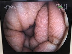 Video Gastroscopephoto7