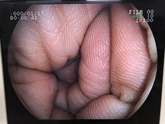 Video Gastroscope｜EG-250WR5｜Fujifilm Medical photo7