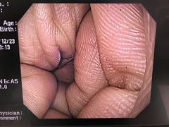 Video Gastroscope｜GIF-Q240｜Olympus Medical Systems photo7