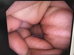 上部消化管汎用ビデオスコープ｜GIF-HQ290｜オリンパスメディカルシステムズ株式会社の写真7枚目
