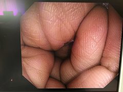 上部消化管汎用ビデオスコープ｜GIF-HQ290｜オリンパスメディカルシステムズ株式会社の写真7枚目