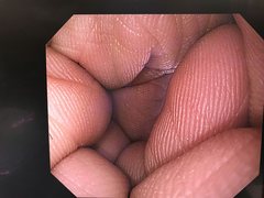 上部消化管汎用ビデオスコープ｜GIF-Q260｜オリンパスメディカルシステムズ株式会社の写真7枚目