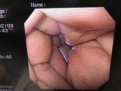 上部消化管汎用ビデオスコープ｜GIF-XQ240｜オリンパスメディカルシステムズ株式会社の写真7枚目