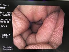 上部消化管汎用ビデオスコープ｜GIF-Q260｜オリンパスメディカルシステムズ株式会社の写真7枚目