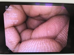 Video Gastroscope｜GIF-PV70｜Olympus Medical Systems photo7