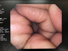 上部消化管汎用ビデオスコープ｜GIF-Q260｜オリンパスメディカルシステムズ株式会社の写真7枚目