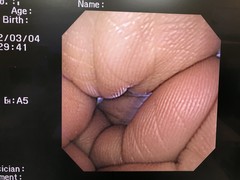 上部消化管汎用ビデオスコープ｜GIF-2T200｜オリンパスメディカルシステムズ株式会社の写真7枚目