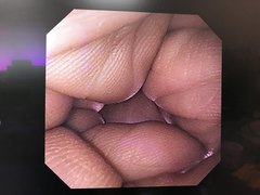 上部消化管汎用ビデオスコープ｜GIF-XP260NS｜オリンパスメディカルシステムズ株式会社の写真7枚目