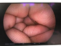 上部消化管用経鼻スコープ｜EG-580NW｜富士フイルムメディカルの写真7枚目