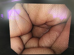 上部消化管汎用ビデオスコープ｜GIF-PQ260｜オリンパスメディカルシステムズ株式会社の写真7枚目