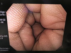 Video Gastroscope｜GIF-Q240X｜Olympus Medical Systems photo7