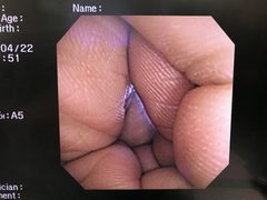 Video Gastroscope｜GIF-2T200｜Olympus Medical Systems photo7