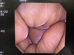 Video Gastroscope｜GIF-XP260｜Olympus Medical Systems photo7