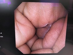 上部消化管汎用ビデオスコープ｜GIF-XP290N｜オリンパスメディカルシステムズ株式会社の写真7枚目