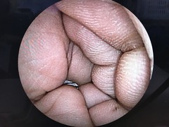 上部消化管用経鼻スコープ｜EG-530N2｜富士フイルムメディカルの写真7枚目