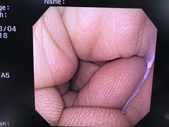 Video Gastroscope｜GIF-XQ240｜Olympus Medical Systems photo7