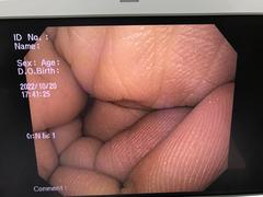 上部消化管汎用ビデオスコープ｜GIF-Q150X｜オリンパスメディカルシステムズ株式会社の写真7枚目