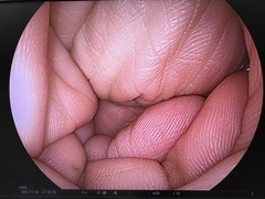 上部消化管用経鼻スコープ｜EG-580NW｜富士フイルムメディカルの写真7枚目