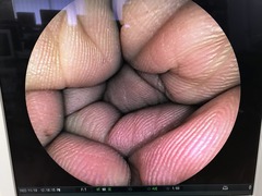 Video Colonoscope｜EC-450WM｜Fujifilm Medical photo7