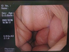 Video Gastroscope｜GIF-Q260｜Olympus Medical Systems photo7