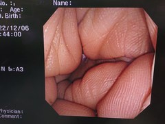 Video Transnasal Gastroscope｜GIF-XP260N｜Olympus Medical Systems photo7
