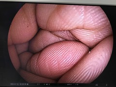 上部消化管用経鼻スコープ｜EG-530NW｜富士フイルムメディカルの写真7枚目