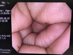 Video Colonoscope｜CF-H260AZI｜Olympus Medical Systems photo7