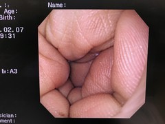 上部消化管汎用ビデオスコープ｜GIF-XQ260｜オリンパスメディカルシステムズ株式会社の写真7枚目