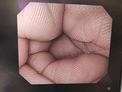 上部消化管汎用ビデオスコープ｜GIF-Q260｜オリンパスメディカルシステムズ株式会社の写真7枚目