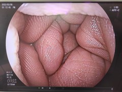 Video Transnasal Gastroscope｜EG-580NW｜Fujifilm Medical photo7