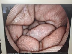 上部消化管用経鼻スコープ｜EG-580NW｜富士フイルムメディカルの写真7枚目