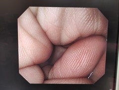 上部消化管汎用ビデオスコープ｜GIF-Q260｜オリンパスメディカルシステムズ株式会社の写真7枚目