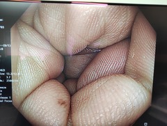 大腸ビデオスコープ｜CF-HQ290ZI｜オリンパスメディカルシステムズ株式会社の写真6枚目