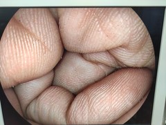 上部消化管ビデオスコープ｜EG-590WR｜富士フイルムメディカルの写真7枚目