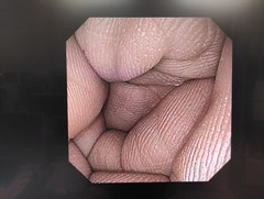 上部消化管経鼻スコープ｜GIF-XP170N｜オリンパスメディカルシステムズ株式会社の写真7枚目