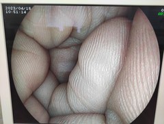 上部消化管用細径スコープ｜EG-3000FP｜富士フイルムメディカルの写真7枚目