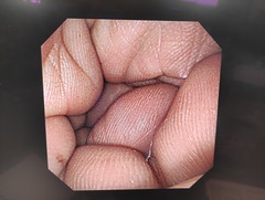Video Gastroscope｜GIF-XP260NS｜Olympus Medical Systems photo7