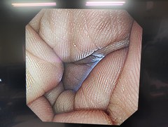 Video Gastroscope｜GIF-XP290N｜Olympus Medical Systems photo7